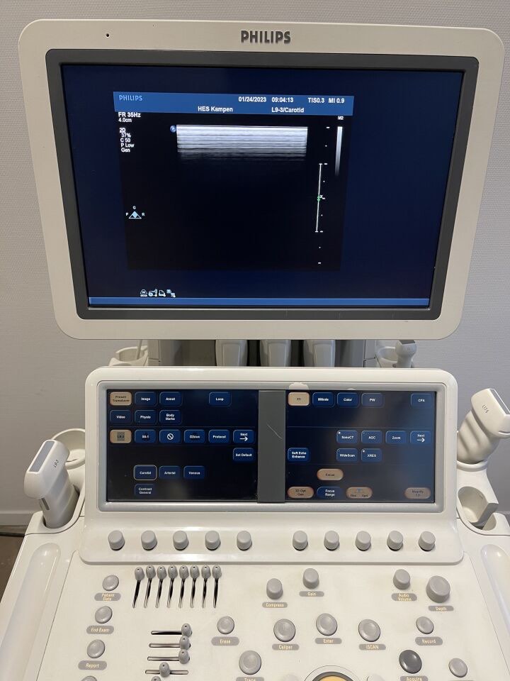 Philips IE33 Ultrasound system